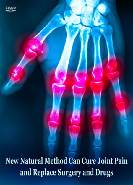 New Natural Method Can Cure Joint Pain and Replace Surgery and Drugs - DVD
