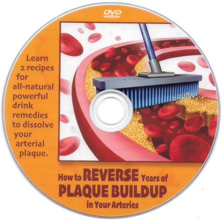 How to Reverse Years of Plaque Buildup in Your Arteries